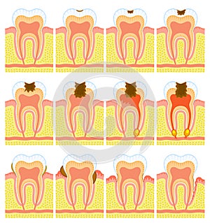 Internal structure of tooth