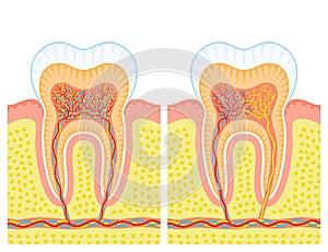 Internal structure of tooth