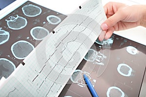 Interpretation of medical tests photo