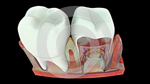 The intersection of the tooth