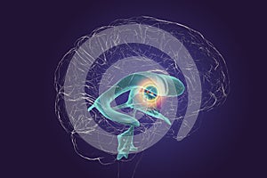 The interventricular foramen, also known as the foramen of Monro, 3D illustration.