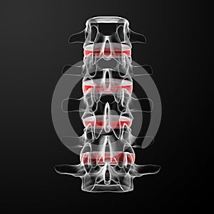 Intervertebral discs