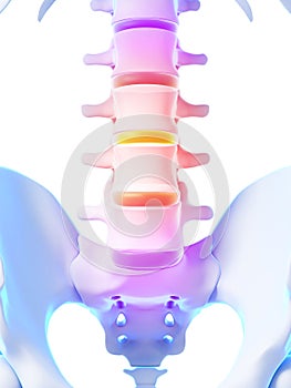 Intervertebral disks