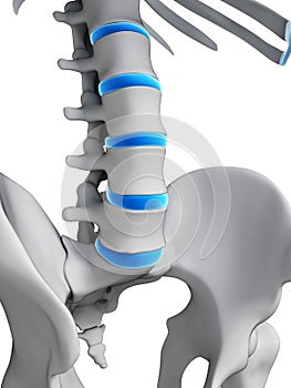 Intervertebral disks