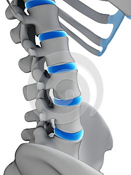 Intervertebral disks