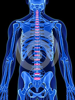 Intervertebral disks