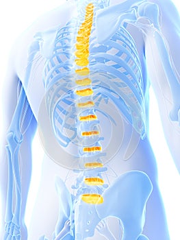 Intervertebral disks