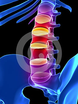 Intervertebral disks photo