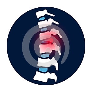 intervertebral hernia concept