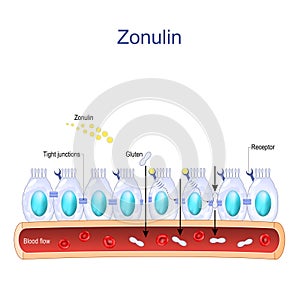 intestinal cells with Zonulin receptors, normal and Faulty tight