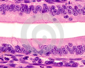Intestinal epithelium. Brush border photo