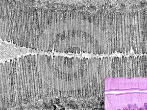 Intestinal epithelium. Brush border photo