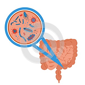 Intestinal flora sign