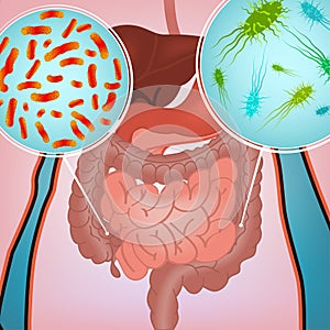 Intestinal infection image photo