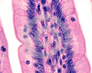 Intestinal epithelium photo