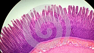 Intestinal wall under a microscope, permanent preparation