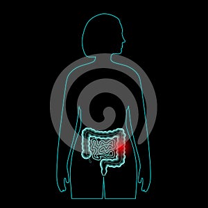 Intestine pain concept