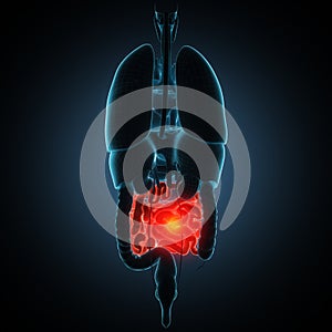 Intestines disease illustration