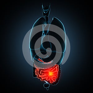 Intestines disease illustration