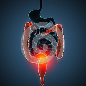 Intestines disease illustration photo