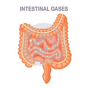 Intestines, guts with bubble isolated on background. Digestive system, tract with intestinal gas. Bloating, gastritis. Digestive