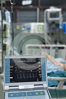 Intraaortic balloon pump