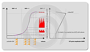 Intracranial Pressure Monitoring ICP waveform, 3d render, 2d graphic