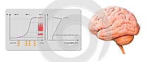 Intracranial Pressure Monitoring ICP waveform, 3d render, 2d graphic photo