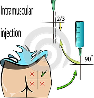 Intramuscular injection. Rules.