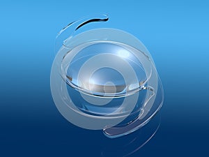 Intraocular lens IOL on blue background, medically 3D illustration