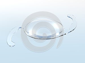 Intraocular lens IOL. Medical 3D illustration  on light bue background