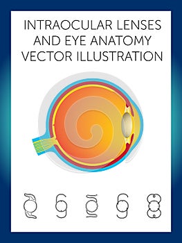 intraocular lenses and eye anatomy vector illustration