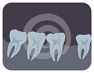 Intraoral radiograph of human teeth and gingiva. Dental x-ray picture or radiographic monitor image, side view. Medical