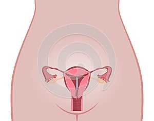 Intrauterine Device IUD