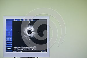 Intravascular ultrasound imaging IVUS . equipment and medical in operating room.