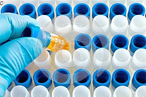 Investigator's hand holding pcr tube at rack in laboratory