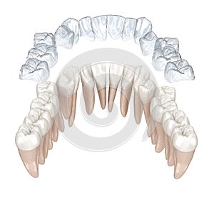 Invisalign braces or invisible retainer make bite correction. Medically accurate 3D animation photo