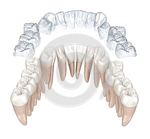 Invisalign braces or invisible retainer make bite correction. Medically accurate 3D animation photo