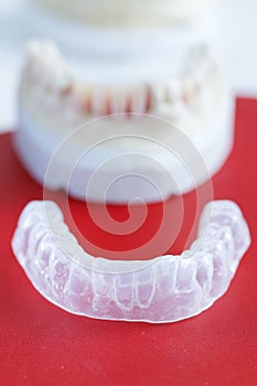 Invisalign, invisible plastic teeth aligner