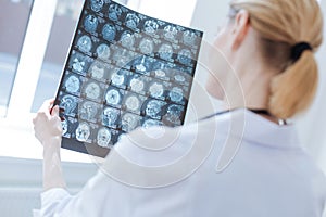 Involved neurosurgeon examining roentgen brain results at the laboratory