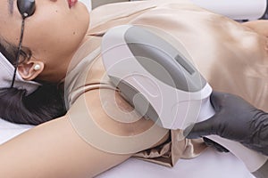 IPL or Intense Pulse Light underarm hair removal procedure done at an aesthetic clinic. A professional IPL hair removal device