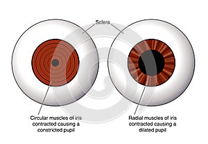 Iris of the eye