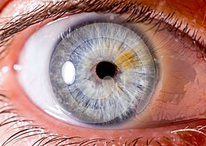 close up eye. close up Iris. very Close macro shot of an eyeball. Blue with fibres and orange streak. photo