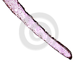 Iris. Sphincter muscle