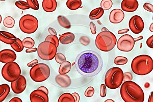 Iron deficiency anemia photo