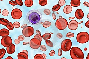 Iron deficiency anemia photo