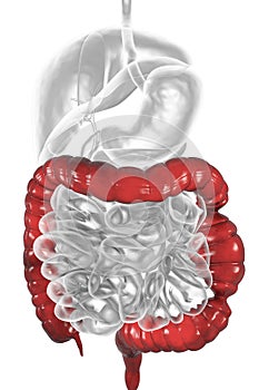 Irritable bowel syndrome IBS medical concept