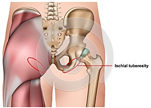 Ischial tuberosity 3d medical vector illustration isolated on white background infographic