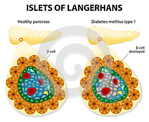 Islets of Langerhans photo