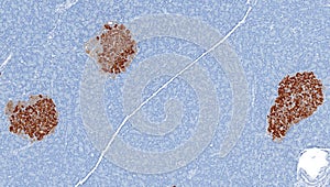 Islets of Langerhans stained brown for Insulin photo